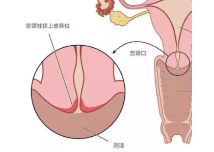 国内哪家做供卵,2026年湖南试管婴儿费用大概需要多少钱 2026年湖南试管婴儿费用大概需要多少钱一次